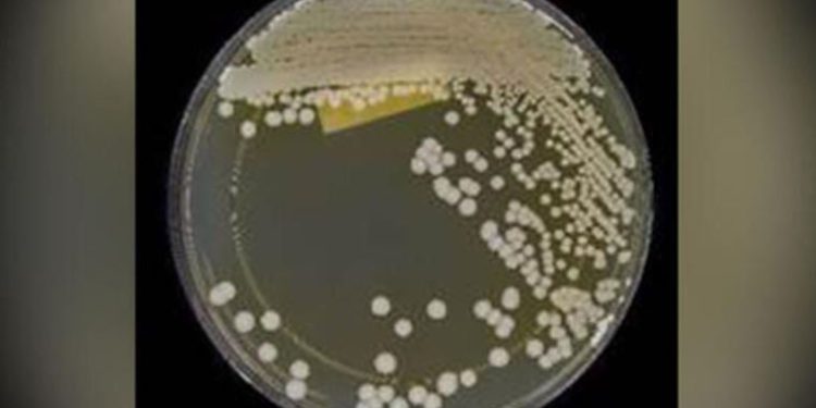 ABD alarmda: İlaca dirençli mantar hastalığı yayılıyor