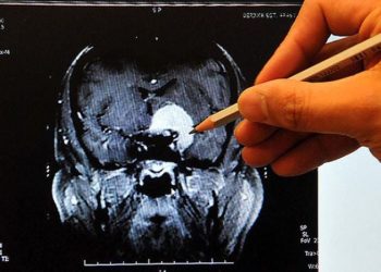 Prof. Dr. Nuri Tutar: ‘Ayakta başlayan pıhtı ölüme kadar götürebilir’