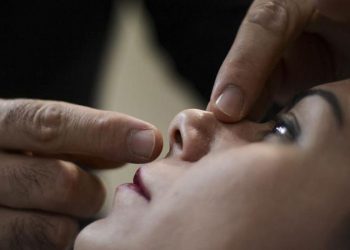 Rinoplasti yaptıracakların ‘Ameliyatta burnum kırılacak mı?’ endişesine uzmanından yanıt