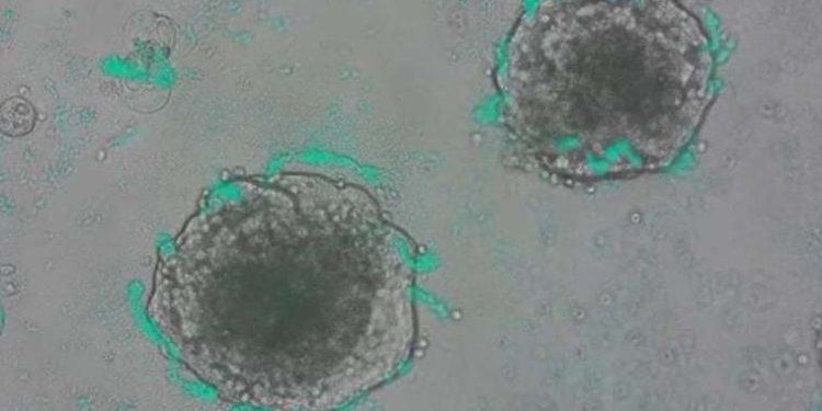 Kanser hücrelerini tespit etmek için bakteriler geliştirildi