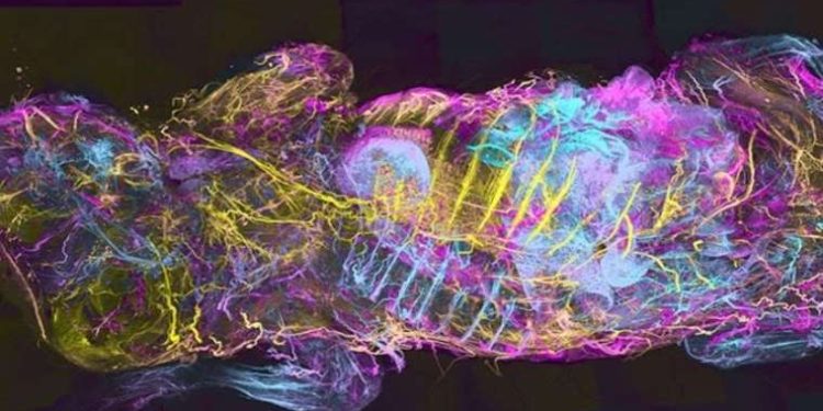 Şeffaf görüntüleme teknolojisi yapay zekayla kansere çözüm sunacak