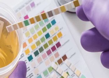 Uzmanı uyardı: İdrarda kan görmeyi hafife almayın