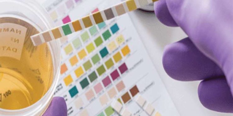 Uzmanı uyardı: İdrarda kan görmeyi hafife almayın