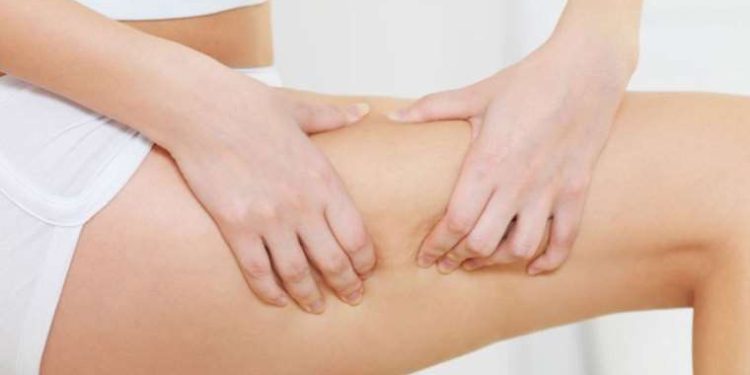 Uzmanından selülit ve çatlakları önlemek için düzenli beslenme önerisi